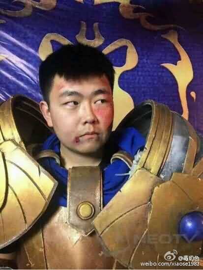 \